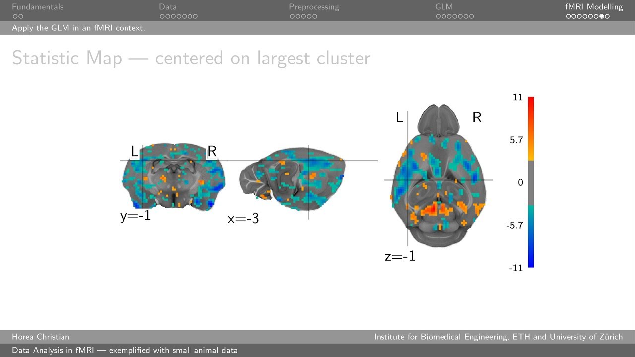 Data Analysis In Fmri Experimental Neuroimaging Course 2018 Zurich
