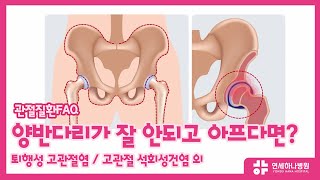 양반다리하면 잘 안되고 아파요! 고관절 질환 알아보기!