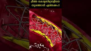 ചീത്ത കൊളസ്‌ട്രോളിനെ തുരത്താന്‍ ഏത്തപ്പഴം.!! | Ethnic Health Court #Shorts