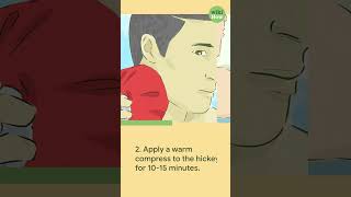 How to Get Rid of a Hickey #shorts