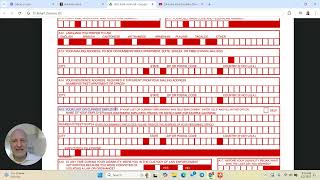 How to Fill Out the California EDD SDI Paper Form (Step-by-Step) | Doctor Explains