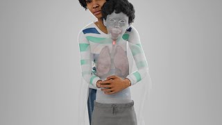 3D Medical Animation – Choking & Abdominal Thrusts