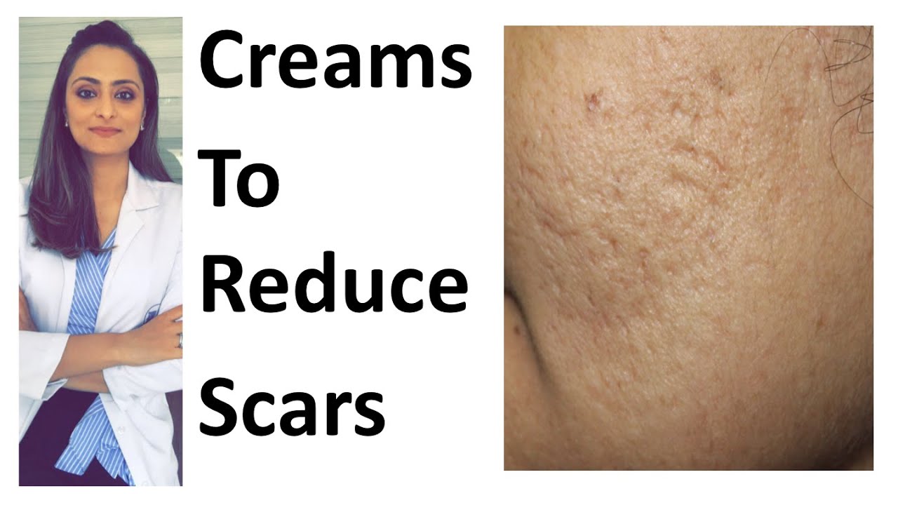 How To Remove Scars | Scar Creams | Tretinoin | Tazarotene | Dr ...