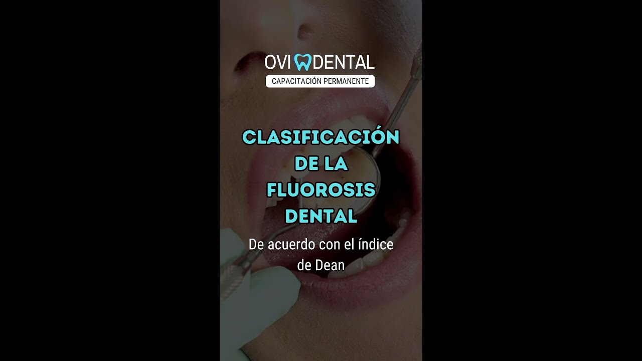 Clasificación De La Fluorosis Dental. De Acuerdo Con El índice De Dean ...