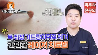 목 쥐젖 겨드랑이 쥐젖 제거 간편한 레이저 치료법✨ 샤워가능! 듀오덤 안붙임!