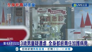 3歲童被虐到\