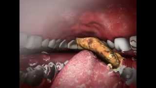 Mechanical Digestion And Chewing: Learn@Visible Body