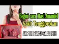 OBAT AMANDEL AMPUH!! Cara mengatasi Amandel Tanpa Operasi! Mudah Atasi Amandel/ Sakit Tenggorokan