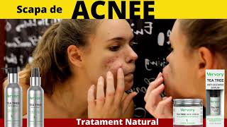 ACNEE, COSURI tratament natural cu 100% ulei pur Organic din Tea Tree