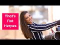 That's How To Know What's Not Herpes With Alexandra Harbushka - Life With Herpes Ep 132