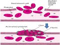 चोट लगने के बाद खून का थक्का कितने समय में बनना चाहिए खून का थक्का देर से बनने के कारण
