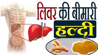 लिवर की बीमारी - हल्दी में है उपाय Liver Problem - Use Haldi