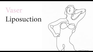 What is Vaser Liposuction,  and recovery time - The Swan Clinic | Plastic Surgeon Dr Reema Hadi