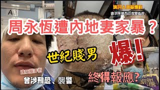 周永恆遭大陸妻家暴？世紀賤男被控刑恐、襲警入獄