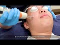 acne scars treatment at dr ko