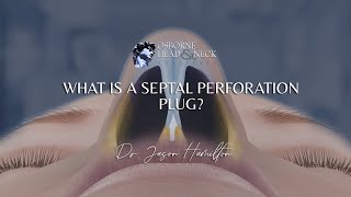 What is a septal perforation plug?