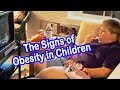 Signs of Obesity in a Child