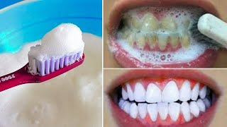 3 Minute Whitening Recipe That Will Have Your Teeth Looking Like Diamonds!