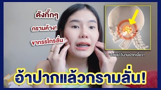 อ้าปากแล้วมีเสียงกึก: ขากรรไกรลั่นเวลาเคี้ยวอาหารหรือว่าเวลาอ้าปาก ? | AMARI A (TMDs)