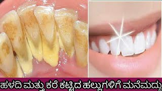 ಹಳದಿ ಮತ್ತು ಕರೆ ಕಟ್ಟಿದ ಹಲ್ಲುಗಳಿಗೆ ಮನೆ ಮದ್ದು|how to whiten teeth at home|home remedy for yellow teeth