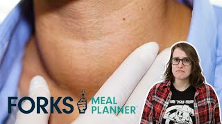 Forks Over Knives Promotes a Dangerous Vegan Diet