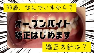 33歳、歯列矯正はじめます。