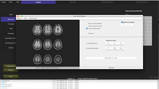 Resting state functional connectivity in CONN (#1)