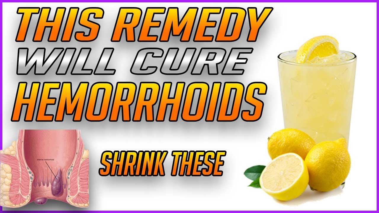 How To Get Rid Of Hemorrhoids Fast And Naturally - BEST REMEDY - How To ...