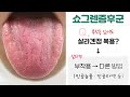 쇼그렌증후군 때문에 살라겐을 먹는데 심장이 두근거려요