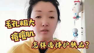 毛孔粗大痘痘肌怎样选择护肤品？控痘消炎，收细毛孔，平衡水油