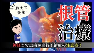 根管治療　虫歯が神経まで進行した場合の治療の注意点について解説します