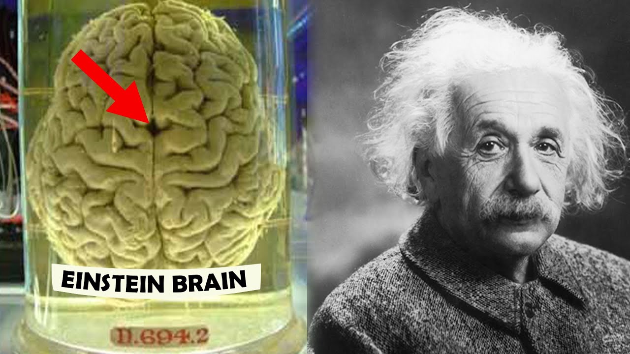 How Einstein S Brain Was Different Go It