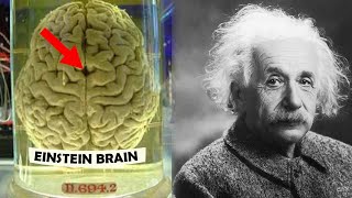 How Einstein's Brain was Different ?