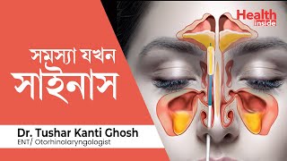 সাইনাস কি, সাইনাস কেন হয় এবং সাইনাসের ঘরোয়া চিকিৎসা | What is sinus? sinus home remedy in Bengali