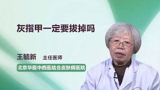 灰指甲一定要拔掉吗 王毓新 北京华医中西医结合皮肤病医院