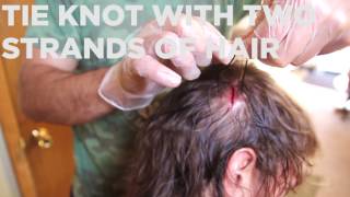 How to Super Glue a Head Wound (w/Hair)