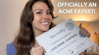 I'm Officially an ACNE EXPERT! | Jadeywadey180