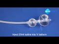 induction with balloon how to use cervical ripening balloon scw medicath