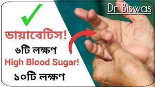 ব্লাড সুগারের লক্ষণ ও ডায়াবেটিসের লক্ষণ ।Signs blood sugar is High \u0026 Diabetes Symtoms । Dr Biswas