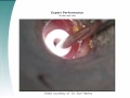 simtube project myringotomy and tube placement resident tutorial