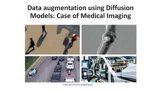 Data augmentation using Diffusion Models, case of medical imaging