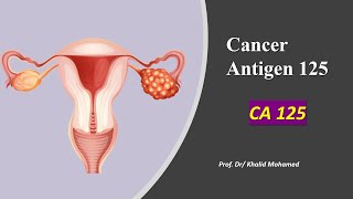 Cancer Antigen 125 (CA 125)