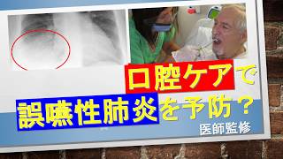 【口腔ケアと誤嚥性肺炎】口腔ケアで誤嚥性肺炎が予防できるって本当？どのくらい有効なの？口腔ケアの中身は？歯磨きだけでよいの？費用対効果は？