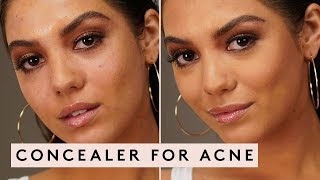 CONCEALER FOR ACNE | FENTY BEAUTY