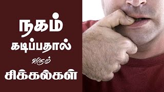 நகம் கடிக்கும் பழக்கம் | Stop Nail Biting | Nails Biting Effects