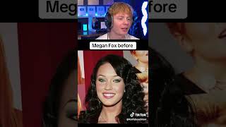 Celebrities Before And After Plastic Surgery