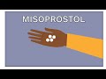 How to use Misoprostol for abortion | Ami Explains Abortion