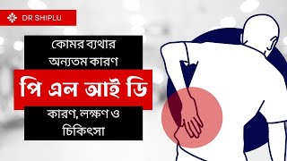 কোমর ব্যথার অন্যতম কারণ পি এল আই ডিঃ কারণ, লক্ষণ ও চিকিৎসা