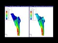 Optimization of hip implant done with SIMULIA Abaqus & Tosca