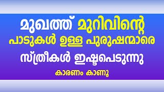 മുഖത്ത് മുറിവിന്റെ പാടുകൾ ഉള്ള പുരുഷന്മാരെ സ്ത്രീകൾ ഇഷ്ടപെടുന്നു. കാരണം. കാണൂ / educational purpose